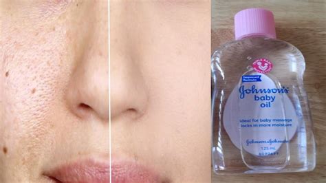 How Can You Use Does Baby Oil Help Dry Skin Effectively?